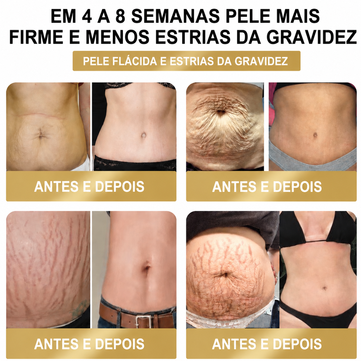 ❤️𝐎𝐟𝐞𝐫𝐭𝐚 𝐋𝐢𝐦𝐢𝐭𝐚𝐝𝐚 𝟖𝟎% 𝐃𝐄 𝐃𝐄𝐒𝐂𝐎𝐍𝐓𝐎 - [𝘋𝘦𝘴𝘦𝘯𝘷𝘰𝘭𝘷𝘪𝘥𝘰 𝘦𝘮 𝘓𝘪𝘴𝘣𝘰𝘢, 𝘗𝘰𝘳𝘵𝘶𝘨𝘢𝘭] 👨‍⚕🌿𝑫𝑨𝑨𝑴𝒀® Adesivo Premium 10 em 1 à Base de Ervas Naturais com Veneno de Abelha (𝚂𝚞𝚒𝚝á𝚟𝚎𝚕 𝚙𝚊𝚛𝚊 𝚞𝚜𝚘 𝚙𝚘𝚛 𝚙𝚎𝚜𝚜𝚘𝚊𝚜 𝚍𝚎 𝚝𝚘𝚍𝚊𝚜 𝚊𝚜 𝚒𝚍𝚊𝚍𝚎𝚜)🔥