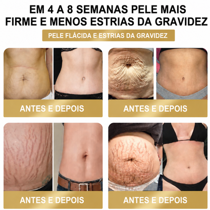 ❤️𝐎𝐟𝐞𝐫𝐭𝐚 𝐋𝐢𝐦𝐢𝐭𝐚𝐝𝐚 𝟖𝟎% 𝐃𝐄 𝐃𝐄𝐒𝐂𝐎𝐍𝐓𝐎 - [𝘋𝘦𝘴𝘦𝘯𝘷𝘰𝘭𝘷𝘪𝘥𝘰 𝘦𝘮 𝘓𝘪𝘴𝘣𝘰𝘢, 𝘗𝘰𝘳𝘵𝘶𝘨𝘢𝘭] 👨‍⚕🌿𝑫𝑨𝑨𝑴𝒀® Adesivo Premium 10 em 1 à Base de Ervas Naturais com Veneno de Abelha (𝚂𝚞𝚒𝚝á𝚟𝚎𝚕 𝚙𝚊𝚛𝚊 𝚞𝚜𝚘 𝚙𝚘𝚛 𝚙𝚎𝚜𝚜𝚘𝚊𝚜 𝚍𝚎 𝚝𝚘𝚍𝚊𝚜 𝚊𝚜 𝚒𝚍𝚊𝚍𝚎𝚜)🔥